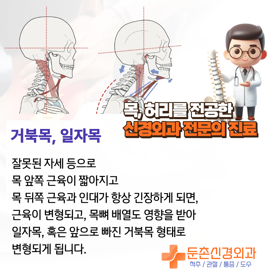 둔촌동 라운드숄더도시치료 거북목도수치료