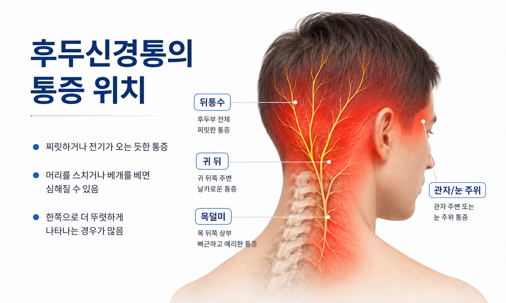 거북목 자세와 후두신경통 원인 이미지