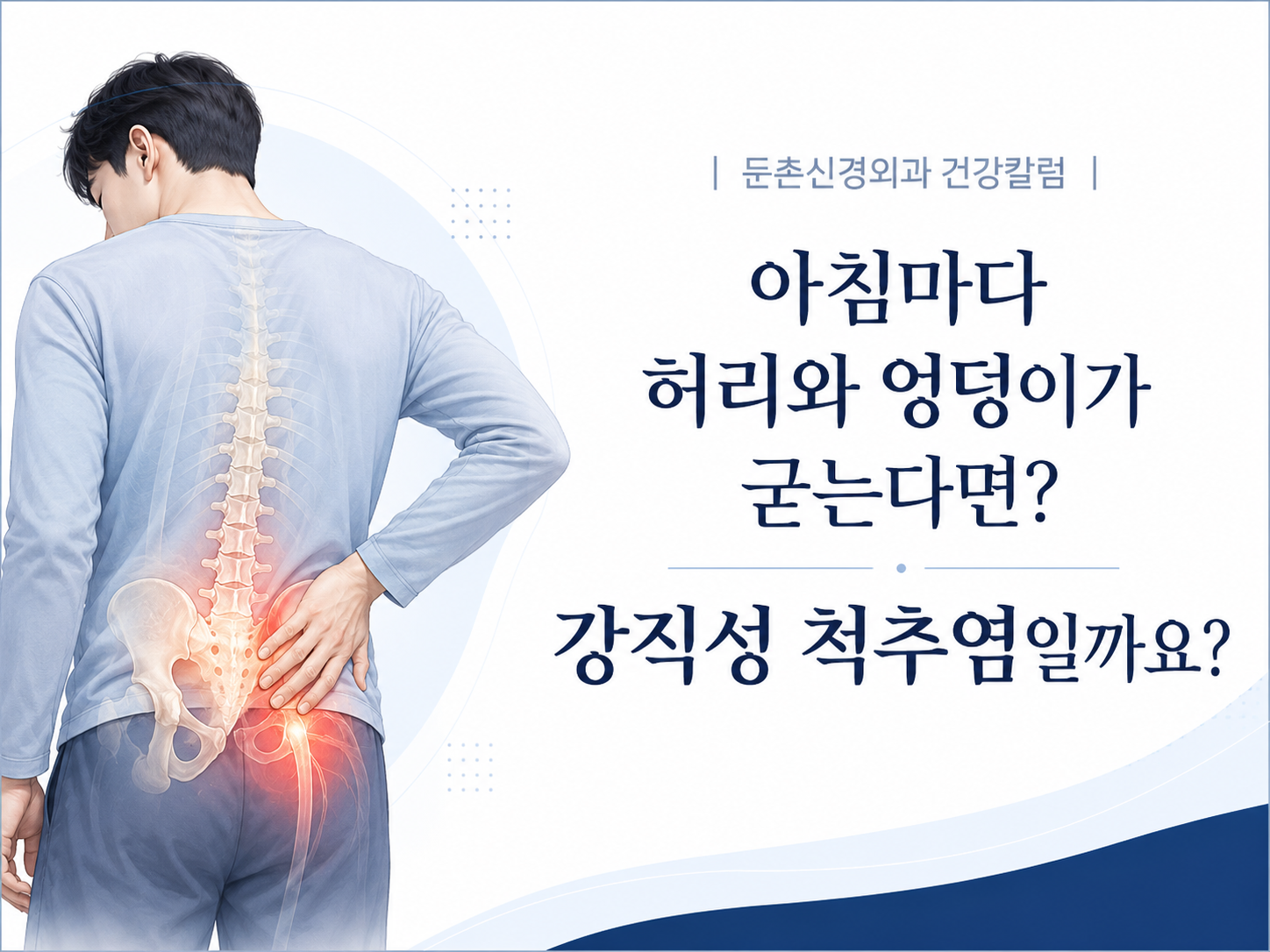 아침마다 허리와 엉덩이가 굳는다면 강직성 척추염일까요?둔촌동정형외과