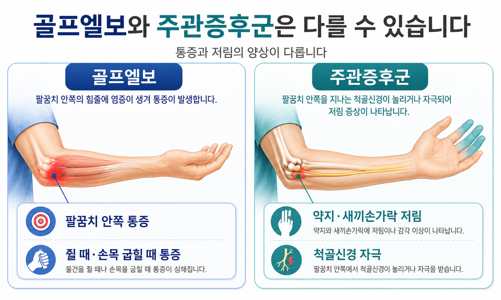 주관증후군 팔꿈치 안쪽 통증과 손 저림